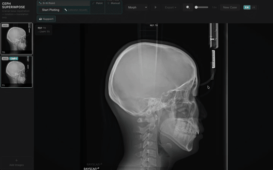 S-N Point auto registration